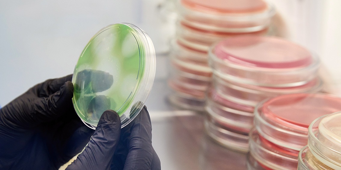 aplicaciones agar Preparación de agar